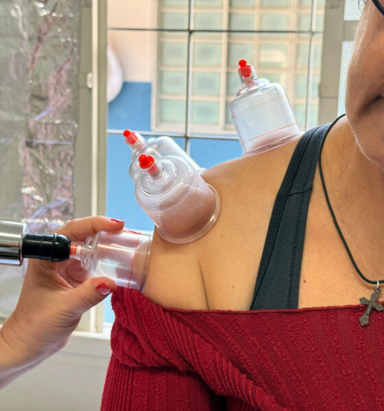 Acupuntura gratuita em Goiânia: SUS oferece tratamento para ansiedade, dores e insônia